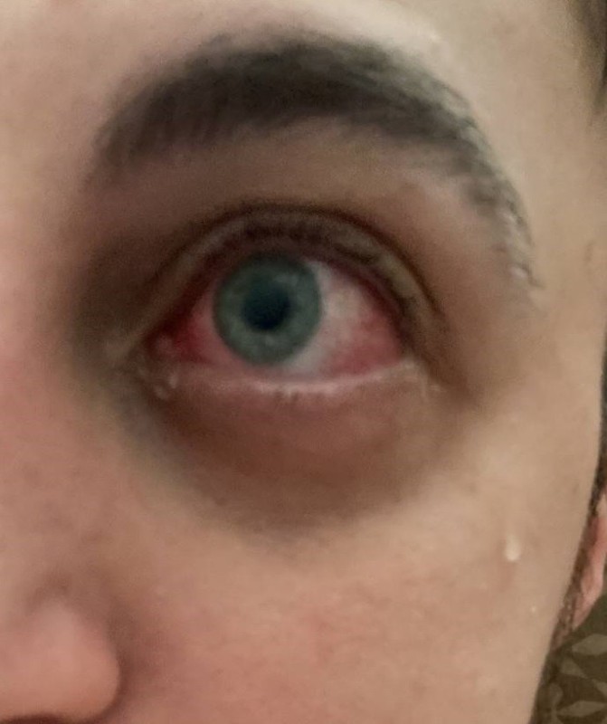 Create meme: red eyes, dry eye, red pupil