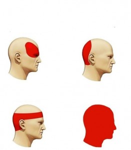 Create meme: baş ağrısı, causes of headache, the different types of headaches