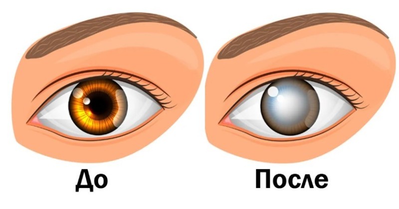 Create meme: eyes vision, glaucoma of the eye, cataract of the eye