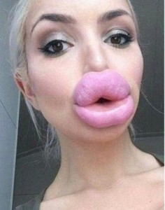 Как выглядят самые большие губы в мире: 8 девушек, переборщившие с филлерами