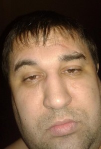 Create meme: Zhelyabin Sergei Roma, male rhinoplasty, deformity of the nose