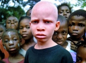 Create meme: africa, albinos in Africa, people with albinism