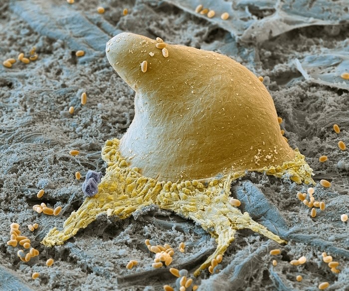 Создать мем: плесневые грибы под микроскопом, раковые клетки под микроскопом, микромир под микроскопом
