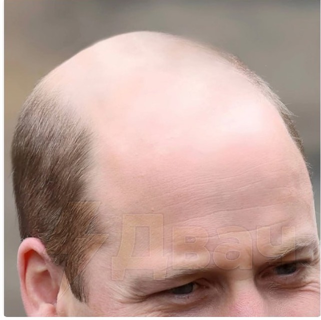 Create meme: the film lenin 2021, bald head, prince william 