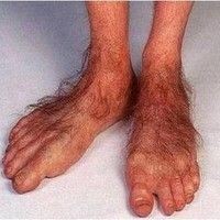 Create meme: foot hobbit, leg volosaty, disease feet