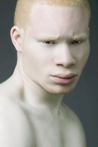 Create meme: Negro albino, people with albinism, albino