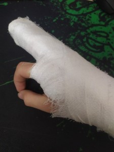 Create meme: broken arm, hand, finger fracture plaster