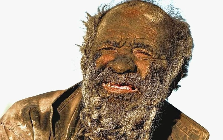 Самого грязного человека. Аму Хаджи самый грязный человек. Аму Хаджи человек который не мылся. Аму Хаджи, который не мылся 60 лет.