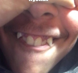 Создать мем: зубки, зубы в кучу, улыбка