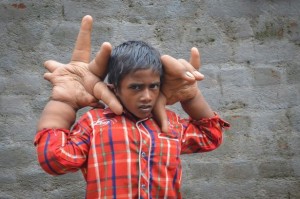 Создать мем: большие руки, самые необычные люди планеты, мальчик из индии с большими руками
