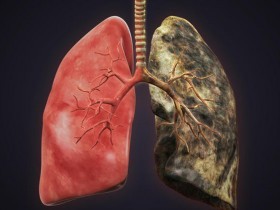 Create meme: lung cancer pictures, lungs of a smoker, human lungs who smokes