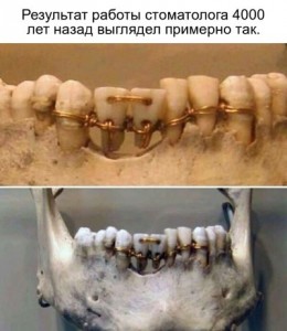 Create meme: prosthetics, dental prosthetics, dentistry in ancient times