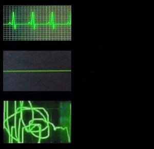 Создать мем: heartbeat meme, пульс мертвого человека, пульс