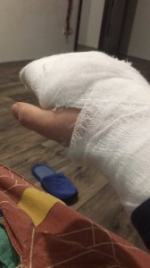 Create meme: broken finger, bandaged hand, the girl's bandaged hand