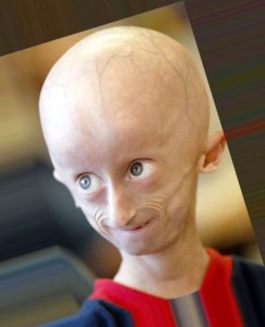 Create meme: small head, big head, progeria