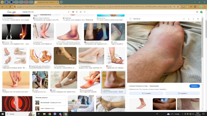 Create meme: tendovaginitis of the ankle joint, ankle joint, arthritis of the ankle joint
