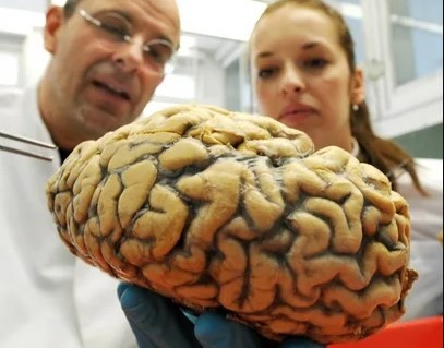Create meme: human brain research, huge brain disease, chalk Board