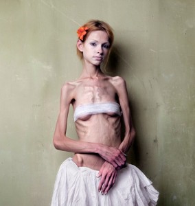 Create meme: anorexia nervosa, anorexia in adolescents, anorexia symptoms