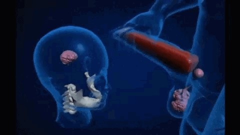 Создать мем: оплодотворение, беременность человека, эмбрион