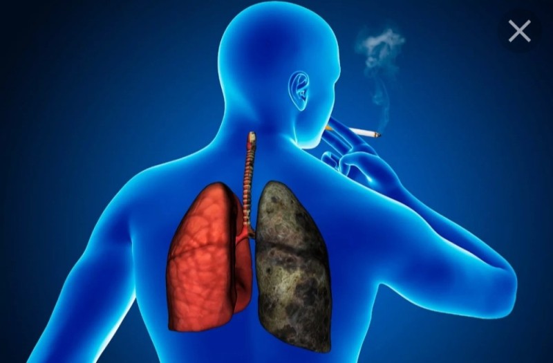 Create meme: light, lungs of a smoker, diseases of the respiratory system