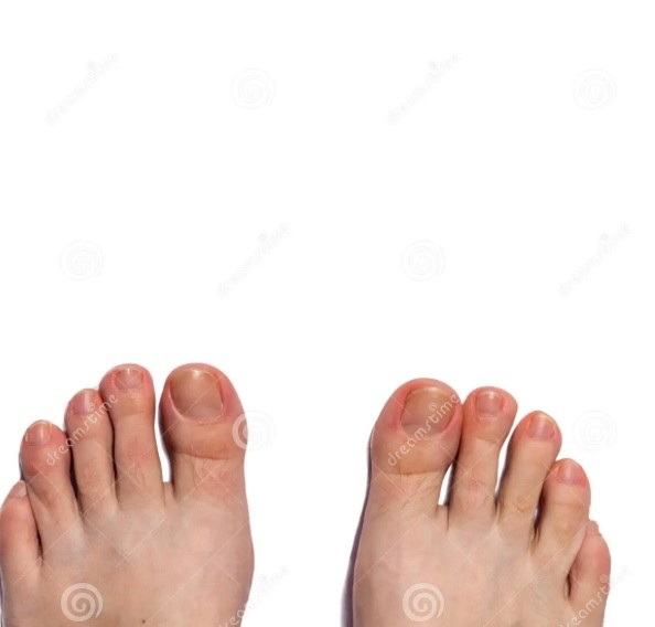 Создать мем: педикюр пальчики, женские пальчики на ногах, часть тела