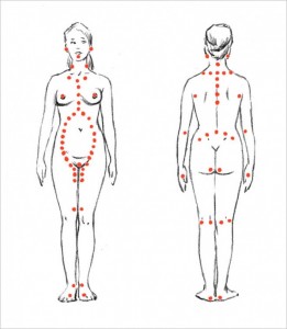 Create meme: trigger points, fibromyalgia point triggers photo, fibromyalgia trigger points