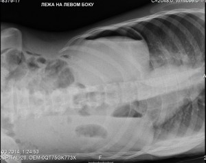 Создать мем: пневмоторакс у кошки рентген, спленомегалия у собаки на рентгене, заворот желудка у собаки рентген