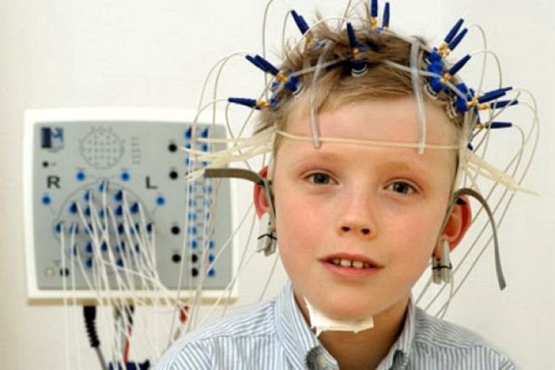 Create meme: eeg, EEG electroencephalography, brain EEG
