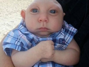 Create meme: boy without a brain, microcephaly in children, Jackson Emmett Buell anencephaly