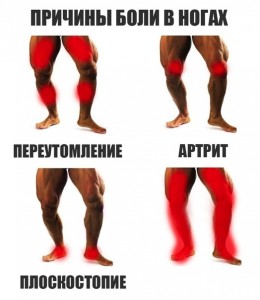 Создать мем: ноги, leg muscle, причины боли боли ног мем