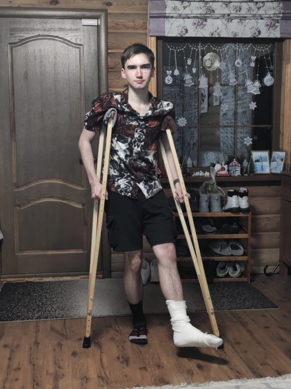Создать мем: новый год со сломанной ногой, ноги, сломанная нога