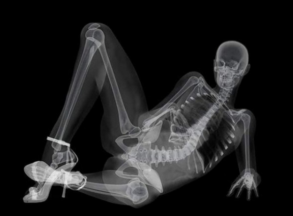 Создать мем "рентген скелет сбоку, рентген женского тела, ренген"...