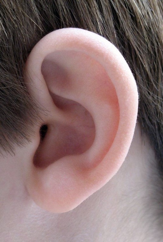 Create meme: lump in the ear, a lump in the ear, traces on the skin