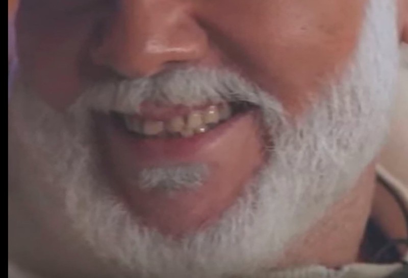 Create meme: teeth , it teeth, uncleaned teeth