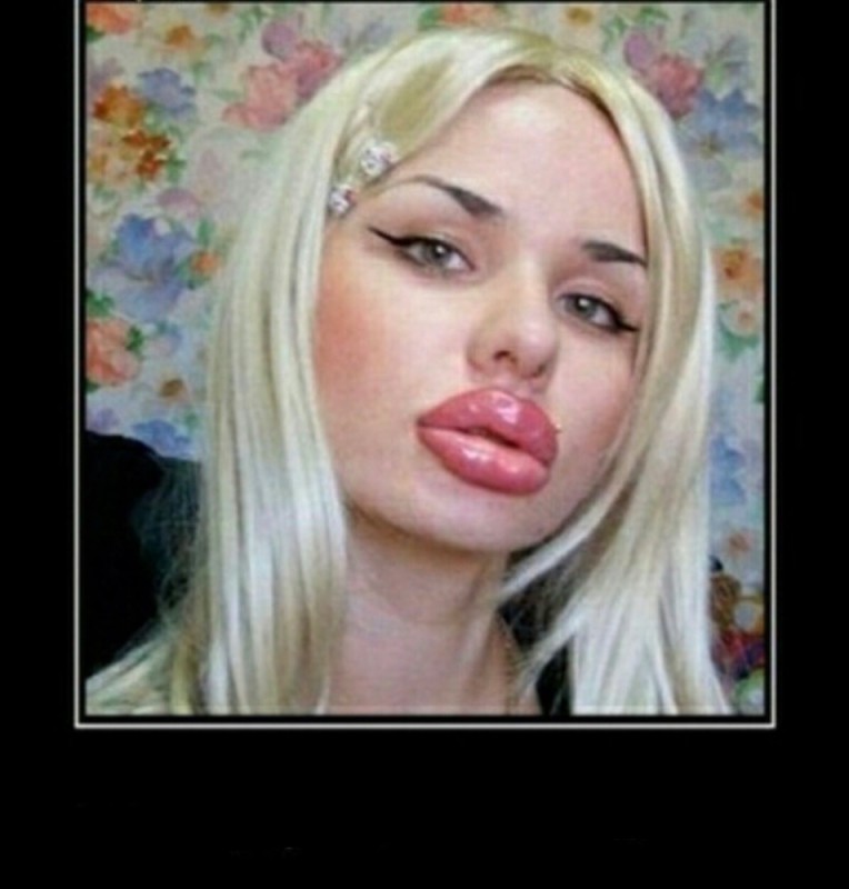 Create meme: big lips, Christina ray , silicone lips 