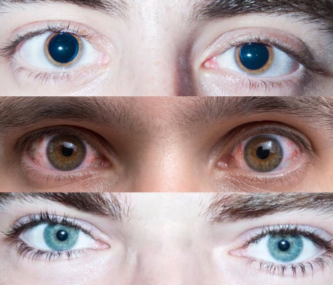 Create meme: body part, meme about eyes, eyes of a drug addict