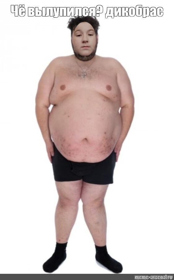 Ноги у толстых людей. Толстяк в полный рост. Жирный человек в полный рост. Толстый мужчина в полный рост.