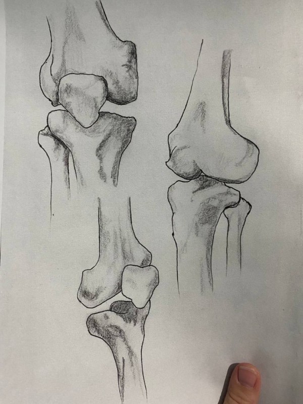 Создать мем: коленный сустав рисунок, дисторсия коленного сустава, часть тела