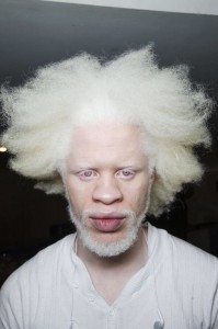 Создать мем: негр белый, афроамериканцы альбиносы, афроамериканец альбинос лео