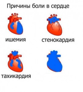 Create meme: comics memes, heart pain, causes of pain in the heart