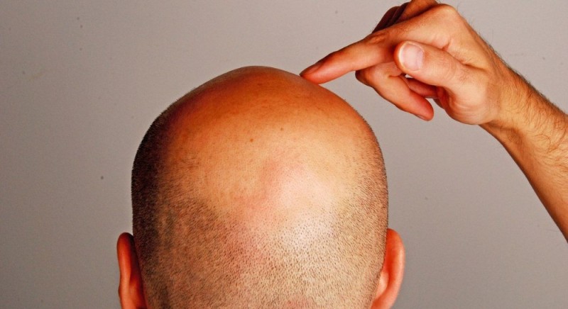 Create meme: bald head, baldness, the head is bald