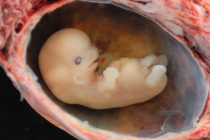 Создать мем: месячный эмбрион человека, зародыш человека, эмбрион