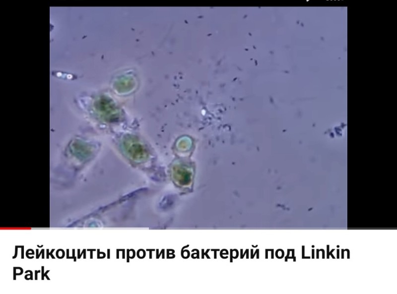 Создать мем: бактерия под микроскопом, giardia spp. под микроскопом, микроорганизмы в воде под микроскопом
