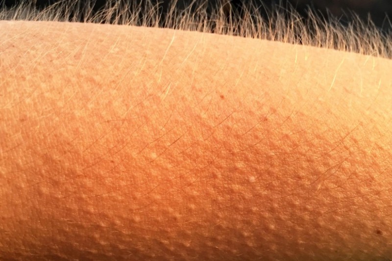 Create meme: goose bumps , formication, goosebumps