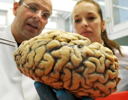 Создать мем: исследование мозга человека, человеческий мозг, огромный мозг болезнь