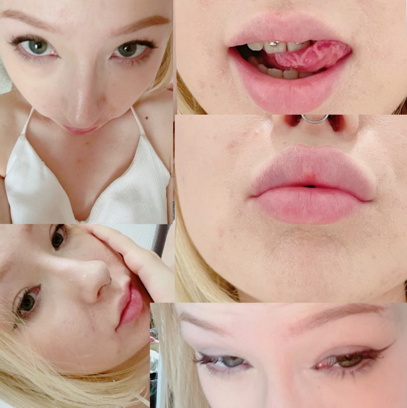 Create meme: lips after enlargement, girl , lip plasty