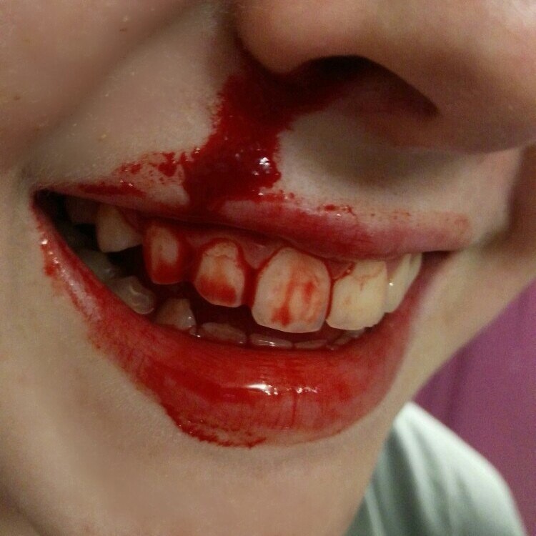 Create meme: tooth blood, broken teeth with blood, teeth 