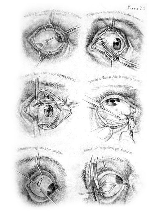 Создать мем: конъюнктивальный мешок глаза, анатомия глаза, конъюнктивальная полость глаза