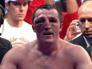 Create meme: Denis Lebedev eye, Lebedev after the fight