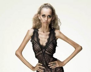 Create meme: anorexia pictures, anorexia girls, model the sun